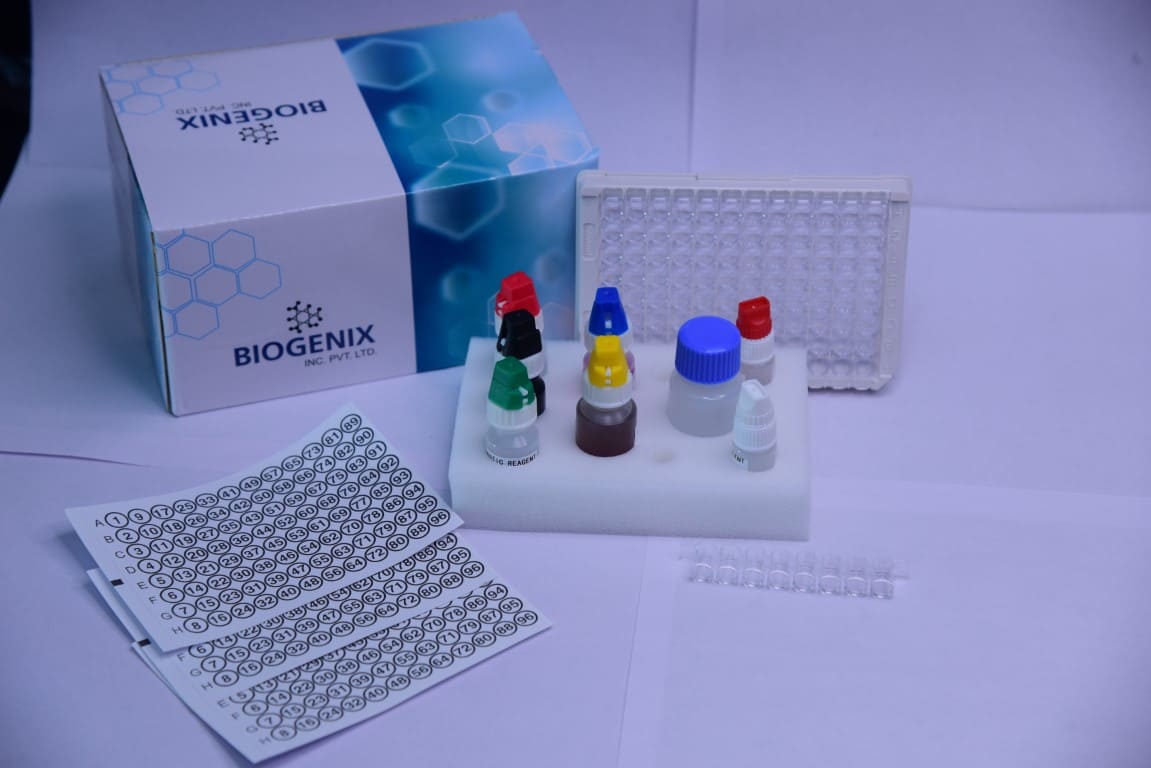 Cardiolipin IgG ELISA Kit